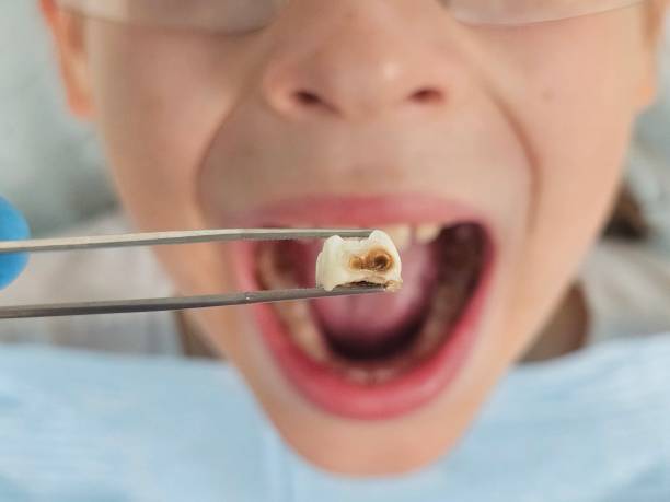 Best Emergency Pediatric Dental Care in West Crossett, AR